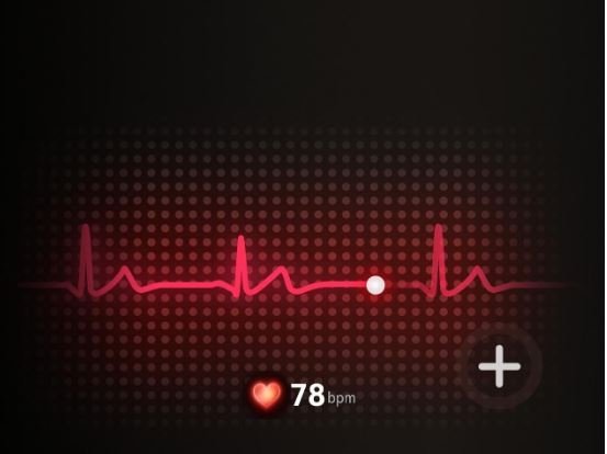 Verändern Smartwatches